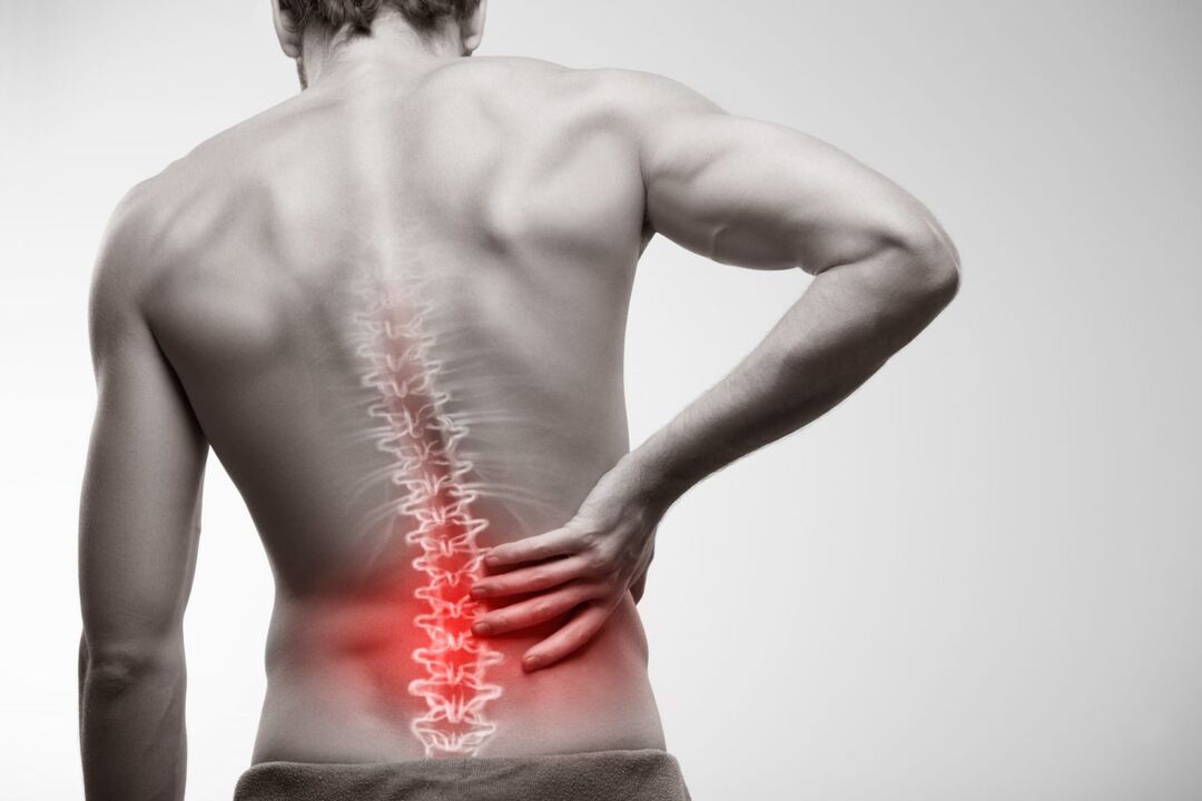 back pain due to osteoarthritis